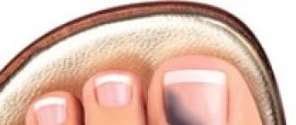 足の親指の黒ずんだ爪 - それは何ですか、そしてそれを治療する方法