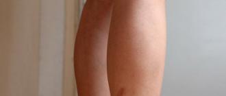 足の傷跡を消す方法と全身の水痘後の写真